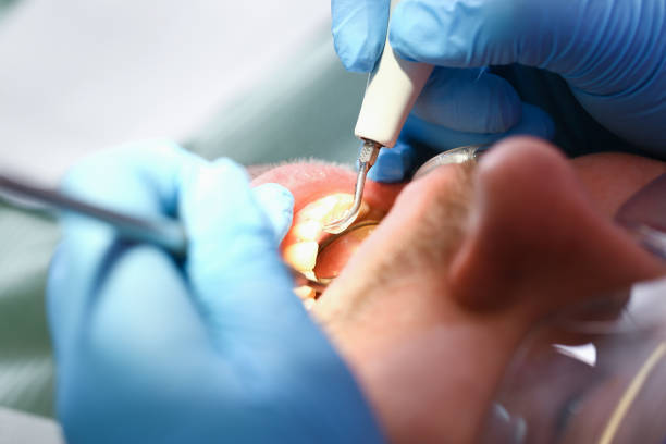 Best Weekend Emergency Dentist in Lake Holiday, IL