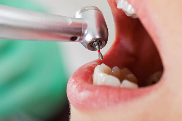 Best Walk-In Emergency Dentist in Lake Holiday, IL